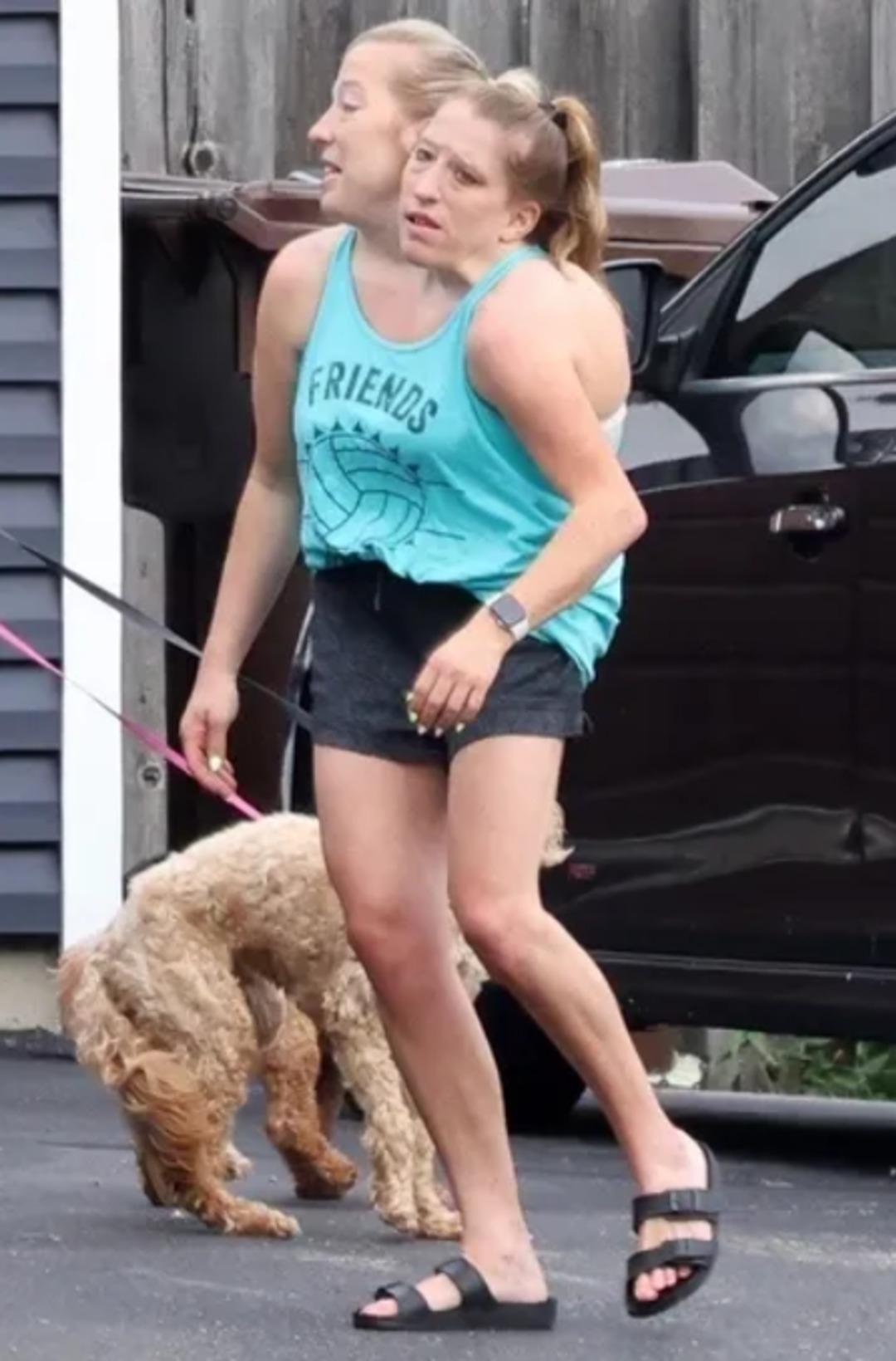 Dünyanın konuştuğu ikizler: Paylaşımları olay olmuştu... Sessizliklerini bozdular! 1