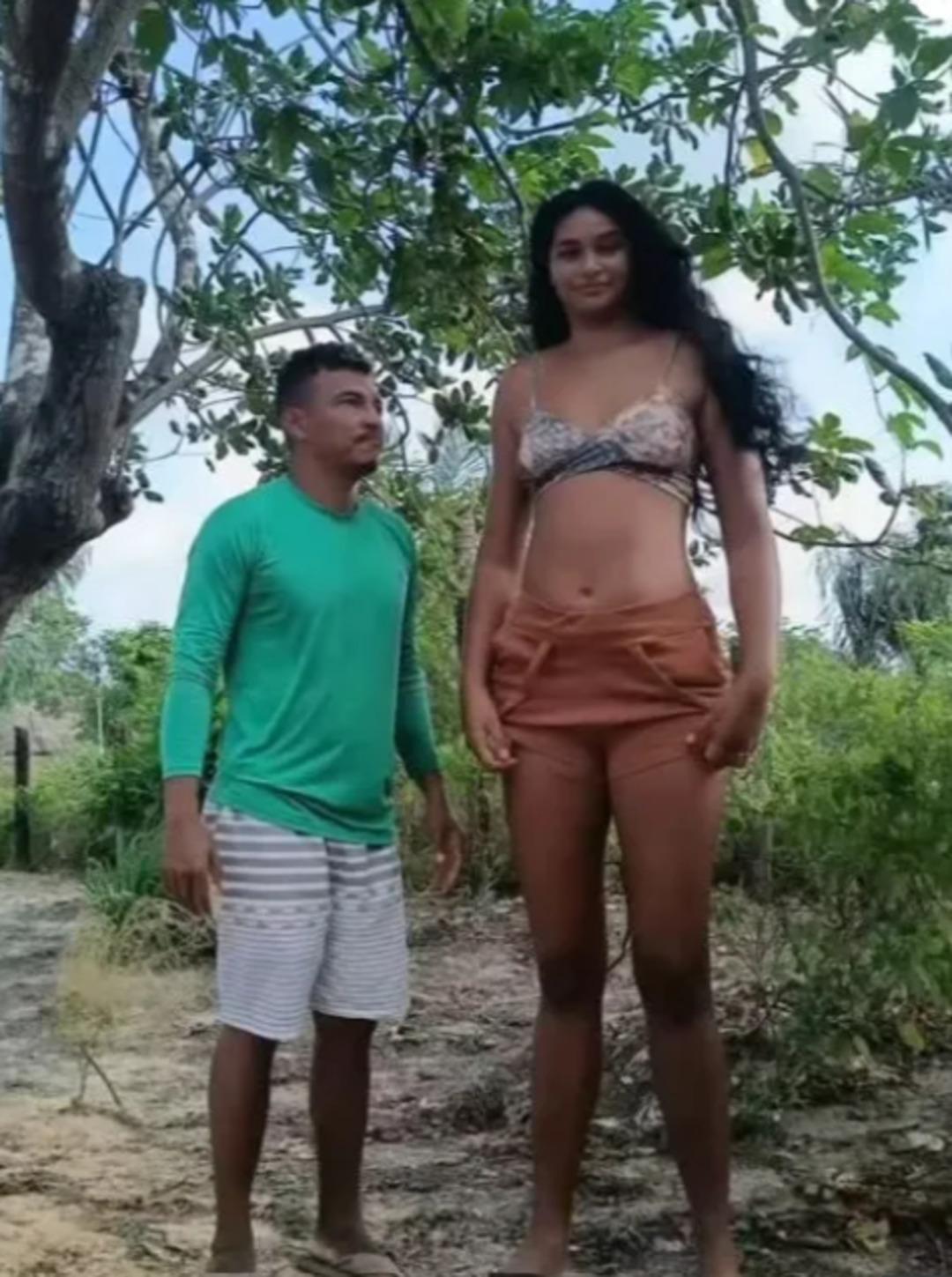 Beynindeki tümör genç kadının boyunu uzattıkça uzattı! Eşiyle arasındaki boy farkı çok konuşuldu 3