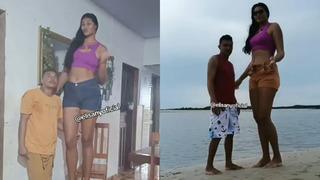 Beynindeki tümör genç kadının boyunu uzattıkça uzattı! Eşiyle arasındaki boy farkı çok konuşuldu