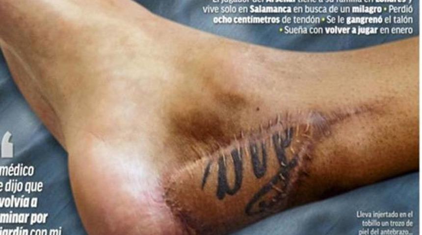 Santi Cazorla az kalsın ayağını kaybediyordu