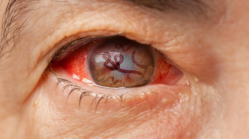 Korkunç hastalık: Resmen içerden çürütüyor! Ebola benzeri virüs 8 kişinin canını aldı