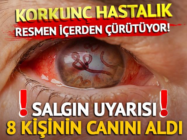 Korkunç hastalık: Resmen içerden çürütüyor! 