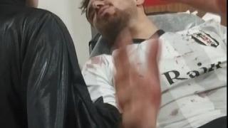 Mahalle maçı kavgaya dönüştü: 2 yaralı