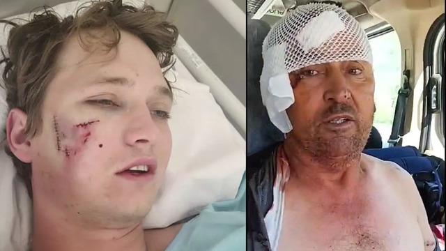 Uyurken sırtlanların saldırısına uğradı! Antalya'da aslan saldırısına uğrayan kişinin yaptığıyla aynı şeyi yaparak hayatta kaldı