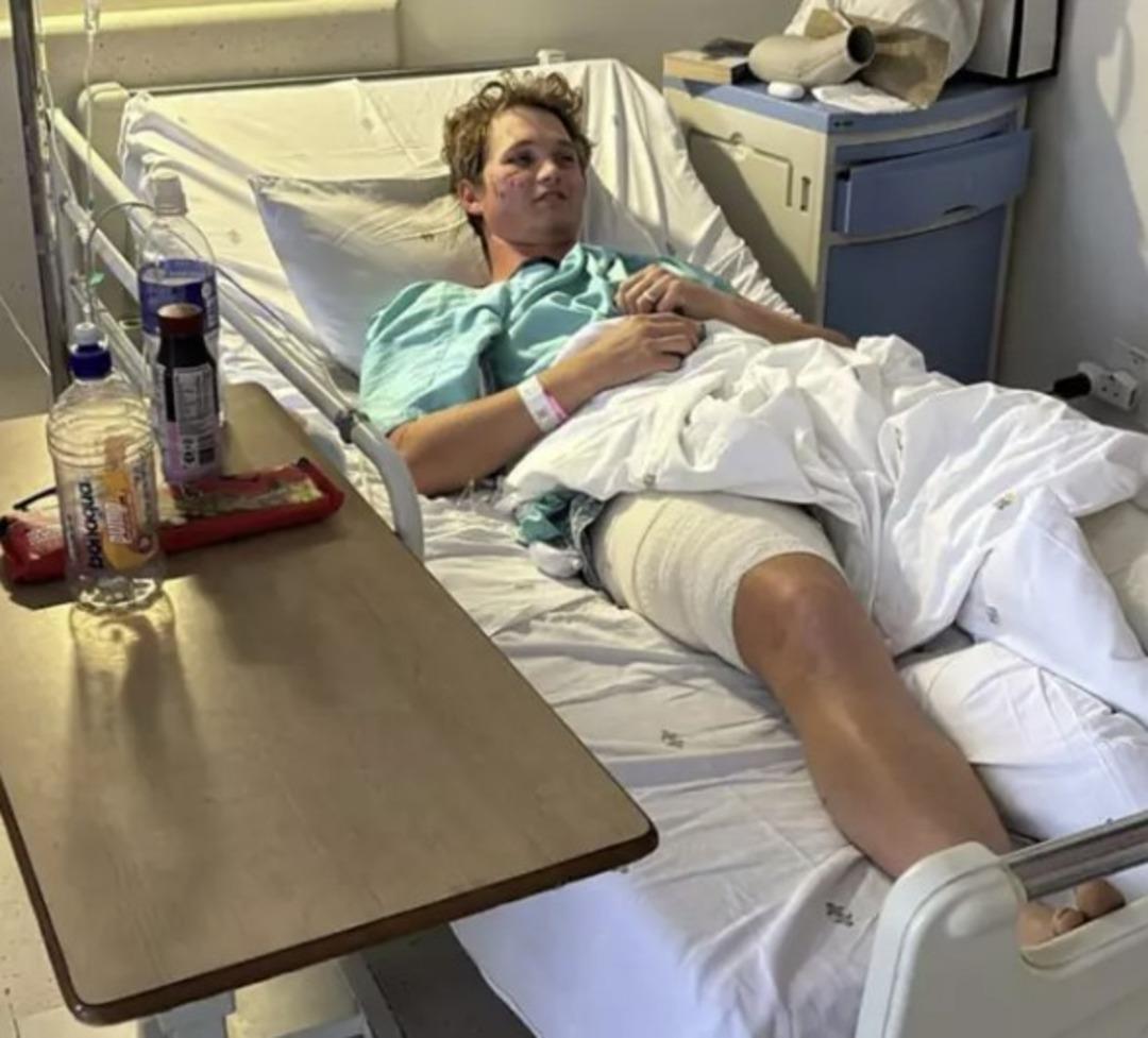 Uyurken sırtlanların saldırısına uğradı! Antalya da aslan saldırısına uğrayan kişinin yaptığıyla aynı şeyi yaparak hayatta kaldı 2