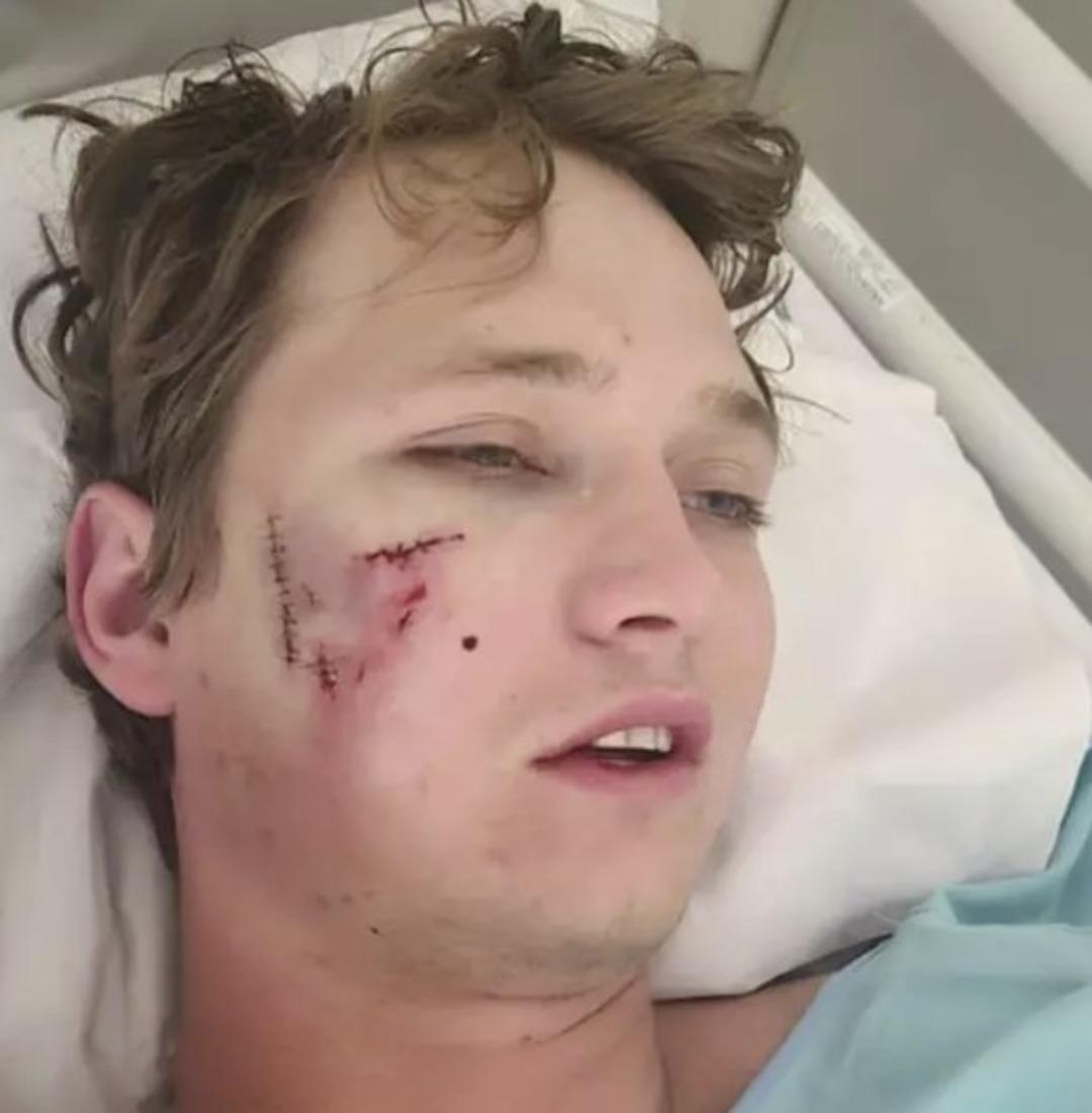 Uyurken sırtlanların saldırısına uğradı! Antalya da aslan saldırısına uğrayan kişinin yaptığıyla aynı şeyi yaparak hayatta kaldı 3