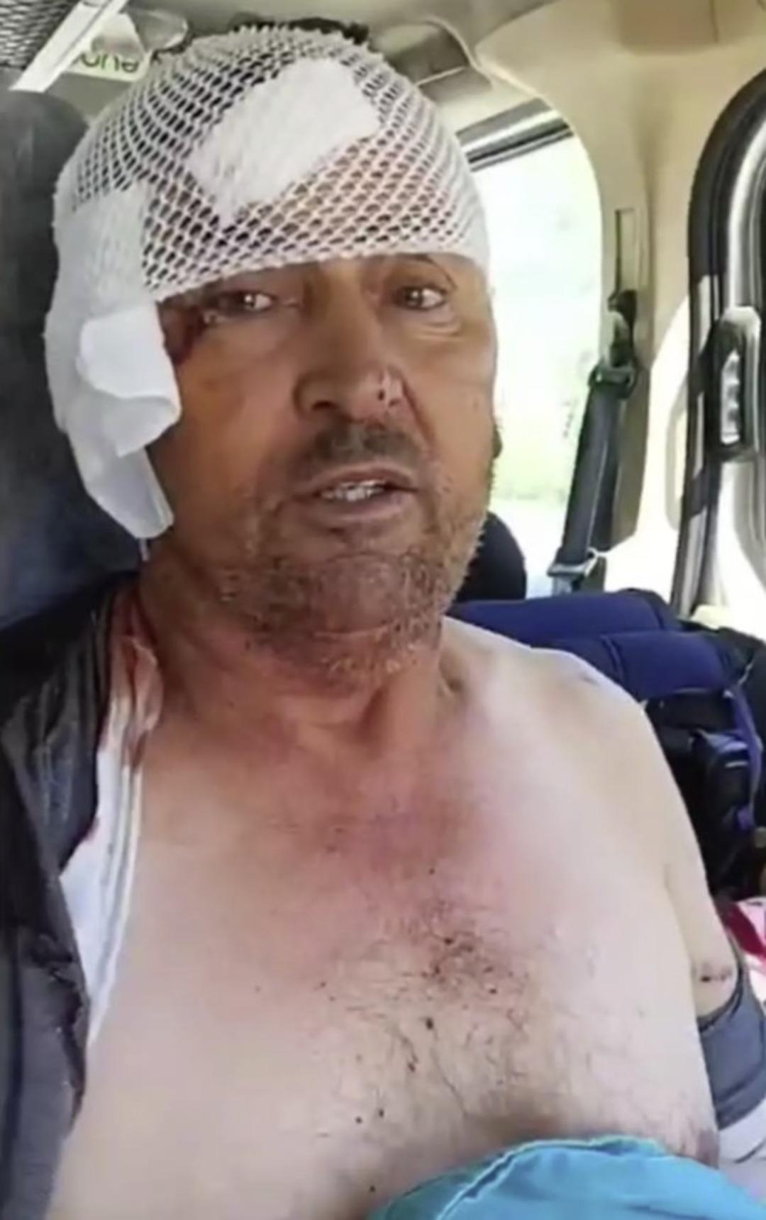 Uyurken sırtlanların saldırısına uğradı! Antalya da aslan saldırısına uğrayan kişinin yaptığıyla aynı şeyi yaparak hayatta kaldı 4