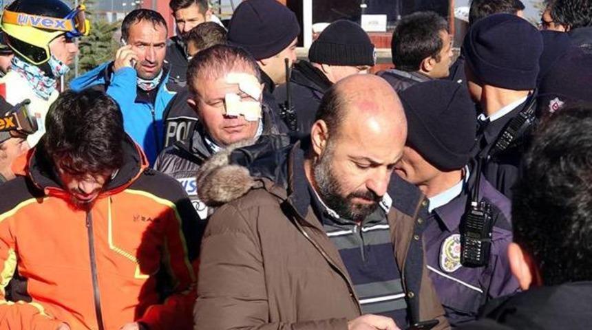 Milli skandal! 5 sporcu gözaltında