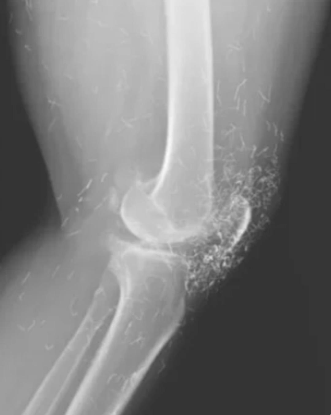 Tedavi diye yaptırdı, vücuduna yayıldı! Altın iplikler röntgenle ortaya çıktı... 2