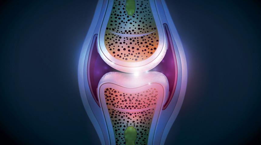 Dizlerde sıvı kaybı nasıl anlaşılır? Dizde sıvı kaybı belirtileri nelerdir?