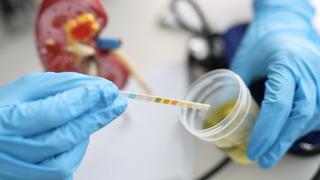 İdrar renginden hastalık anlaşılır mı? İdrar rengi hastalık hakkında ipucu verir mi?