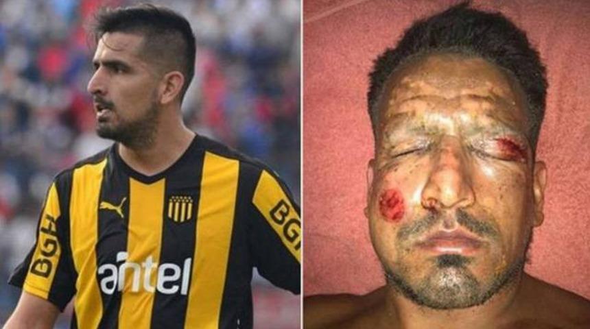 Arjantinli futbolcunun y&uuml;z&uuml;nde havai fişek patladı!