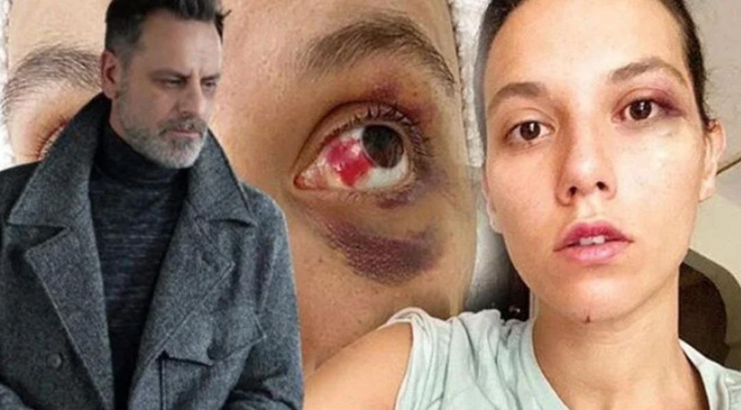 Taciz ifşaları sürerken Ozan Güven de gündeme geldi! Projeden ayrıldı, sessizliğini bozdu: Adalate olan inancımı... 1