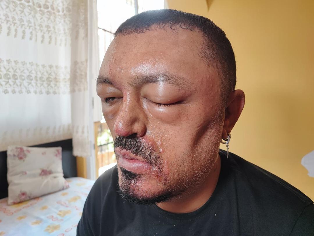 Yer: Adana! Berber tavsiyesi sonrası bu hale geldi! "Gözlerimi kaybedeceğim diye..." 1