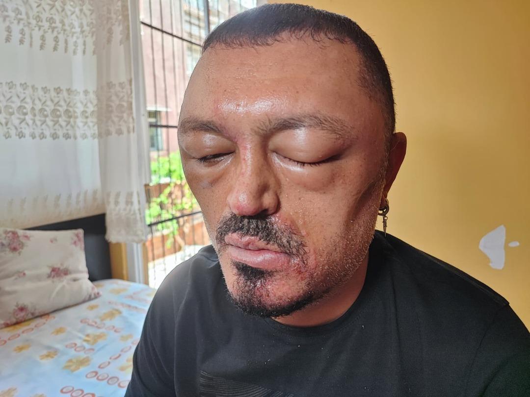 Yer: Adana! Berber tavsiyesi sonrası bu hale geldi! "Gözlerimi kaybedeceğim diye..." 2