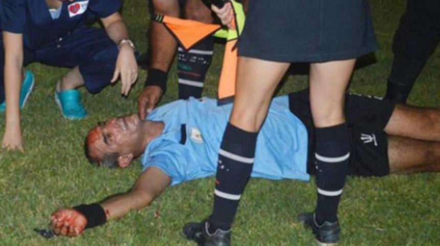 Arjantin'de ma&ccedil;ın hakemini kaskla bayılttılar!