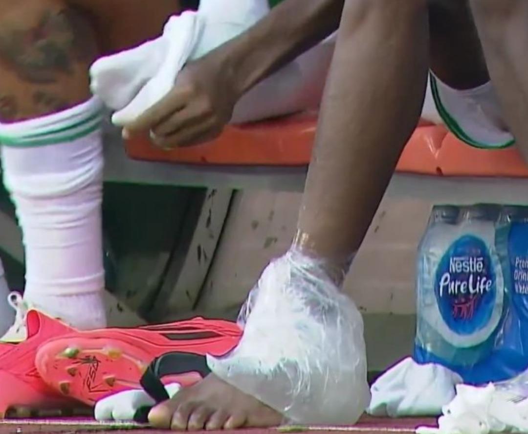 Şampiyonlar Ligi ne günler kala Galatasaray a Osimhen den kahreden haber! Sakatlanarak oyundan çıktı... 3