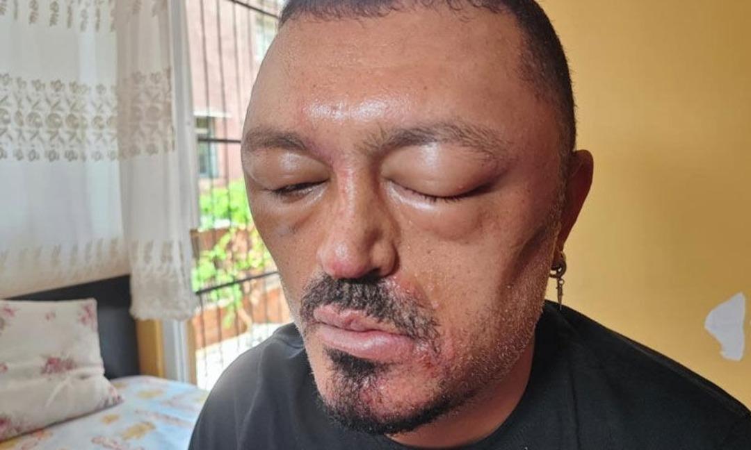 Saçlarındaki beyazları kapatmak istedi, hayatı karardı! İnternetten aldığı şampuan kabusu yaşattı 1