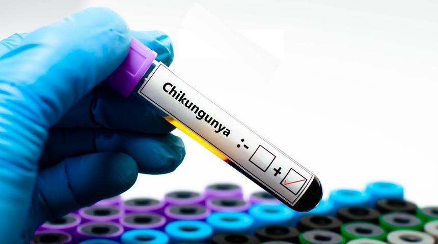 Chikungunya virüsü nedir? Chikungunya virüsü belirtileri ve tedavisi