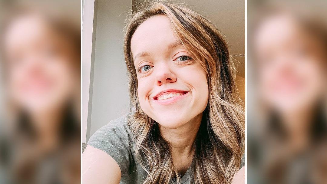 2 milyon dolar verdi! Cüceydi, boyunu 30 cm uzattı! İşte son hali 1