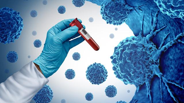 Genetik olarak kansere yatkın mısınız? Uzmanlardan 6 önemli tavsiye: Kanserden korunmak mümkün olabilir…