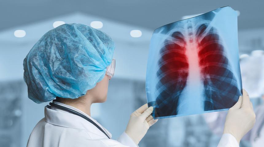 Modern tıpta bile ciddi bir tehdit: Yüksek ölüm oranlarıyla dikkat çekiyor! 