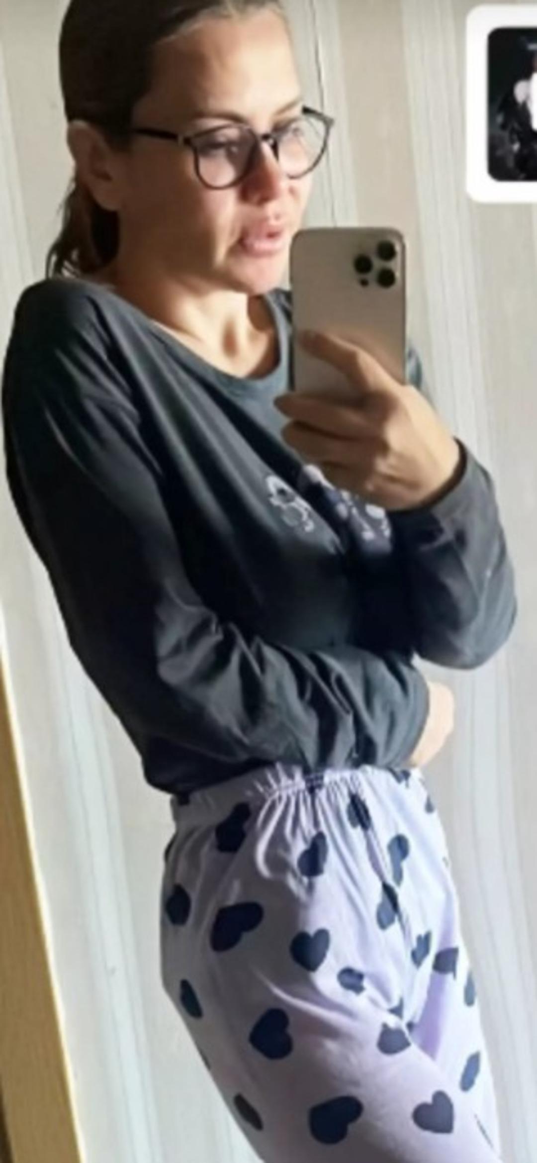 Beyninde kitle tespit edilmişti! Ünlü şarkıcı Lara son durumunu paylaştı!  Artık her şey bambaşka  2