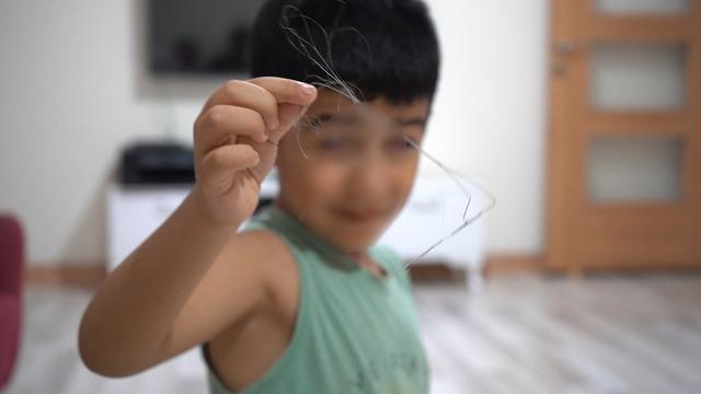 3 yıl sonra ortaya çıktı: 18 santimlik katerer unutmuşlar! Salatalık yutunca ortaya çıktı