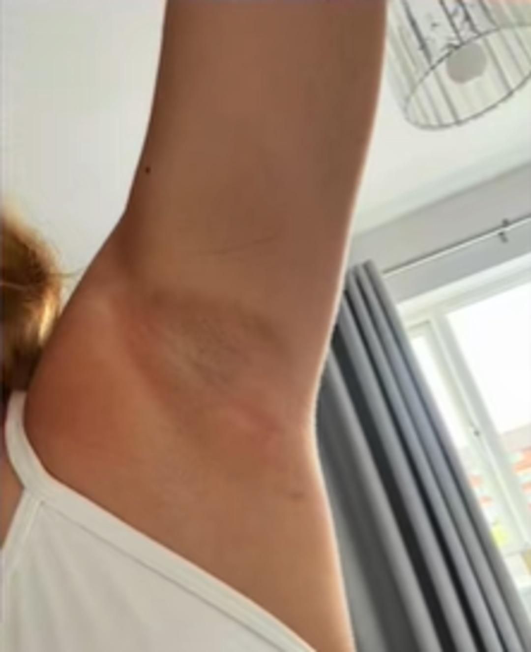 Yanıklar, tahriş ve enfeksiyon... Kötü kokuyu önlemeye çalışırken tüm müşterileri sağlığından oldu! Marka alarma geçti: Geri çağırılıyor 3