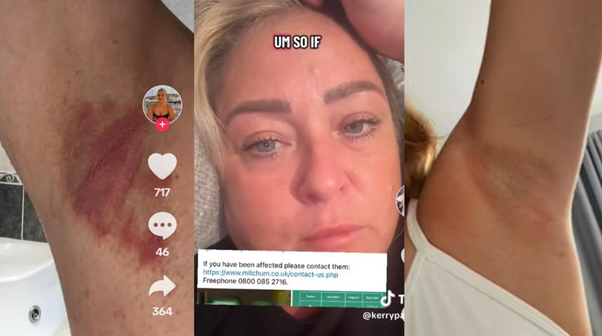 Yanıklar, tahriş ve enfeksiyon... Kötü kokuyu önlemeye çalışırken tüm müşterileri sağlığından oldu! Marka alarma geçti: Geri çağırılıyor