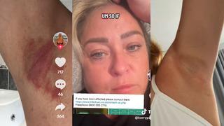 Yanıklar, tahriş ve enfeksiyon... Kötü kokuyu önlemeye çalışırken tüm müşterileri sağlığından oldu! Marka alarma geçti: Geri çağırılıyor