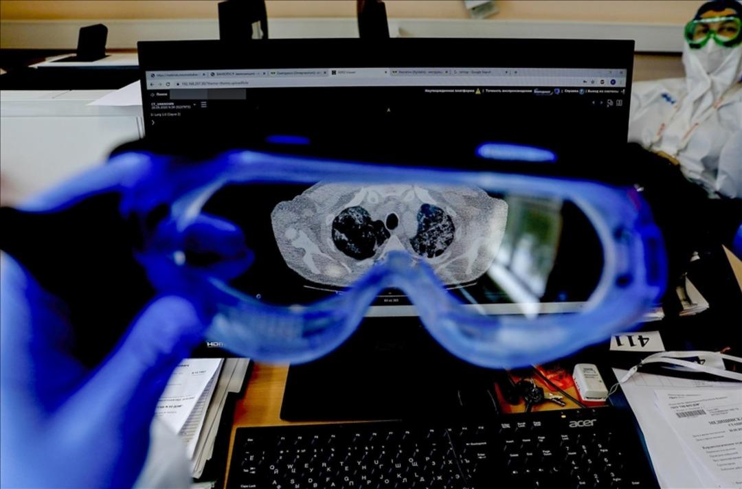 Grip sanabilirsiniz ama 3 senelik kabus... Doktorlar çok net!  Yeniden alevlenme sürecinde  4