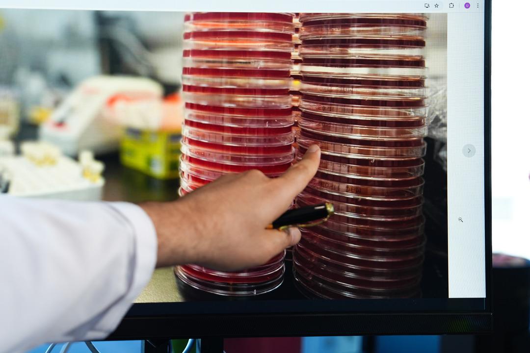 Göz mikropları uzaya taşındı: ‘Göz mikrobiyomu uzay ortamında incelendi’ 2