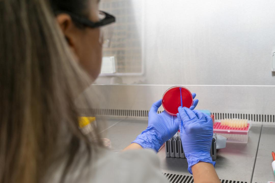 Dünya genelinde milyonlarca insanın ölümüne neden oluyor: "Sepsis hala ciddi bir sorun" Uzmanlardan  Altın Saat  uyarısı! 2