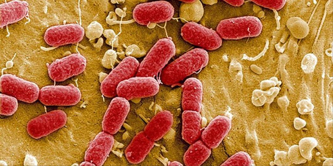 Süpermarket zincirinde bakteri alarmı! İki ürün acil şekilde geri çağırıldı: Enfeksiyon ve böbrek yetmezliğine sebep oluyor 2