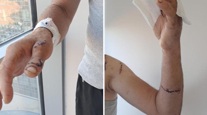 Ayının saldırısına uğrayan çiftçi dehşet anlarını anlattı: "Parmağımı kopardı"