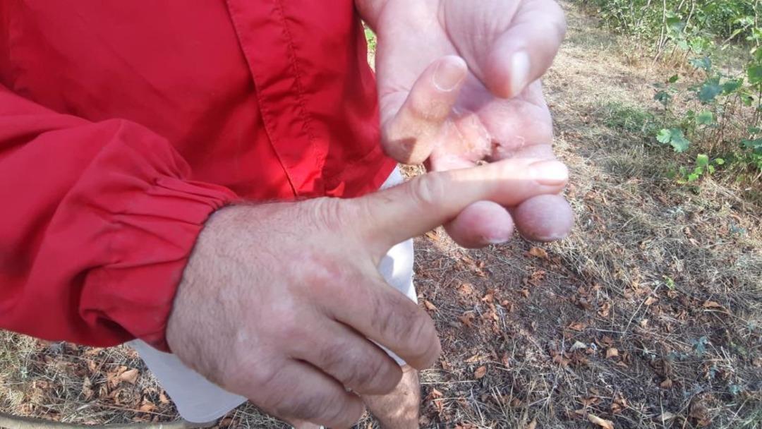 Ayının saldırısına uğrayan çiftçi dehşet anlarını anlattı: "Parmağımı kopardı" 1