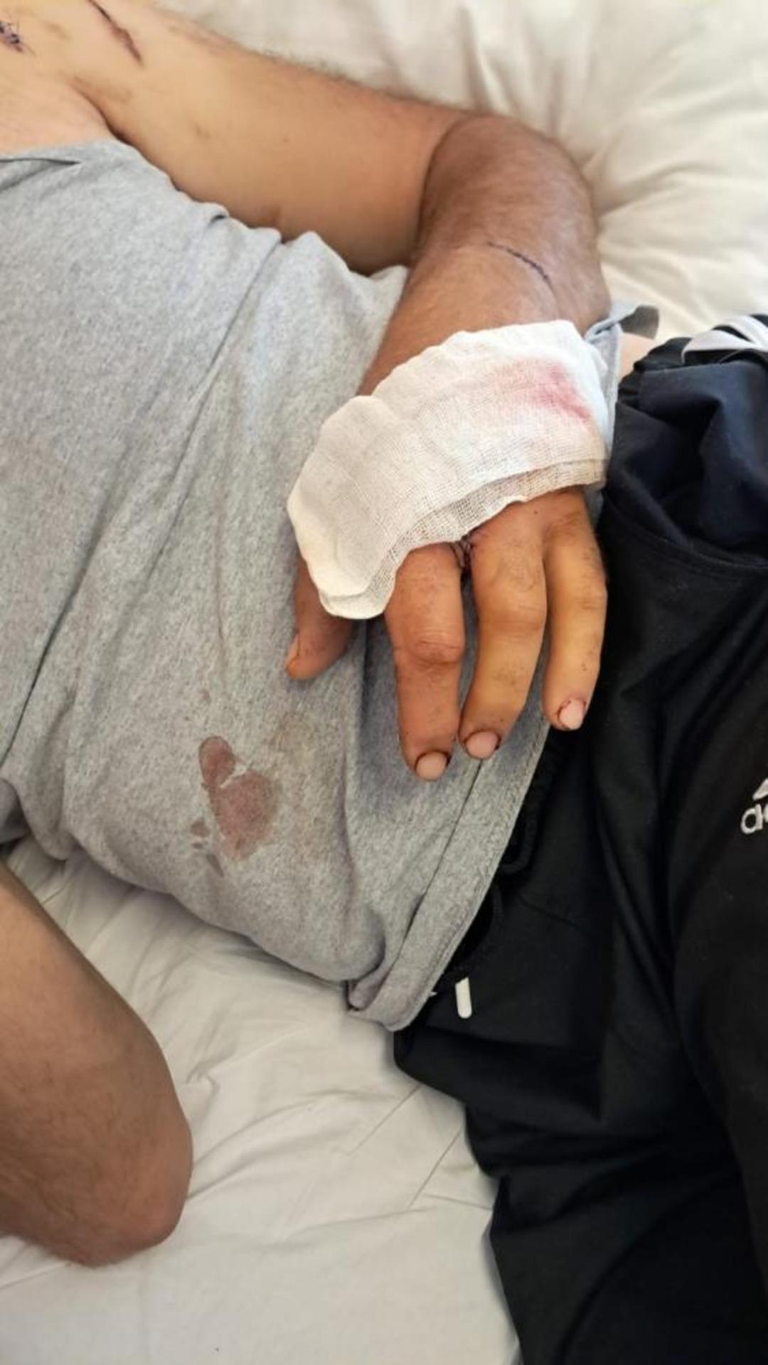 Ayının saldırısına uğrayan çiftçi dehşet anlarını anlattı: "Parmağımı kopardı" 3