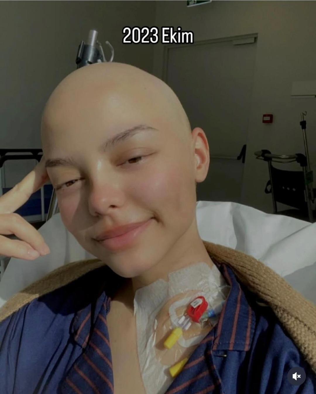 100 kemoterapi 5 ameliyat! Elif in kanser ile sıra dışı mücadelesi sosyal medyada dikkat çekti: ‘Kimseye gerek kalmadan kendimden doğuyorum’ 1