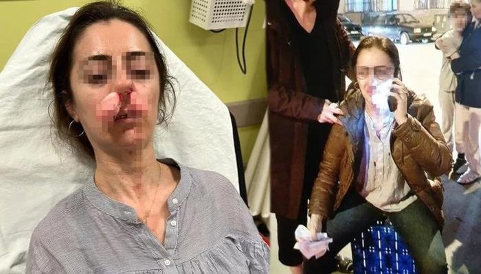 Edirne'de pes dedirten olay: Kocasının sevgilisine benzetip darbetti! Otomobil kapısı silah sayıldı