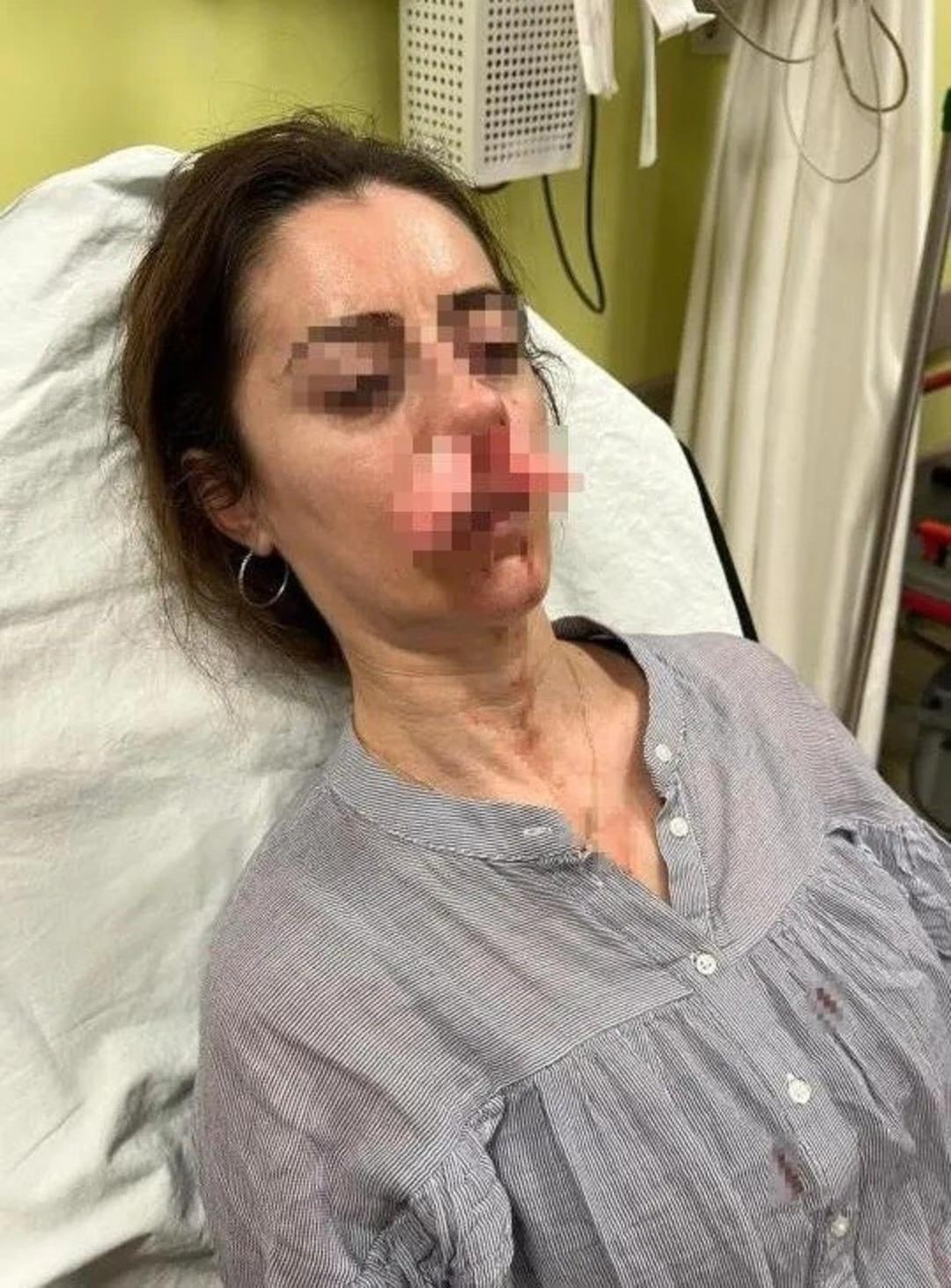 Edirne de pes dedirten olay: Kocasının sevgilisine benzetip darbetti! Otomobil kapısı silah sayıldı 2