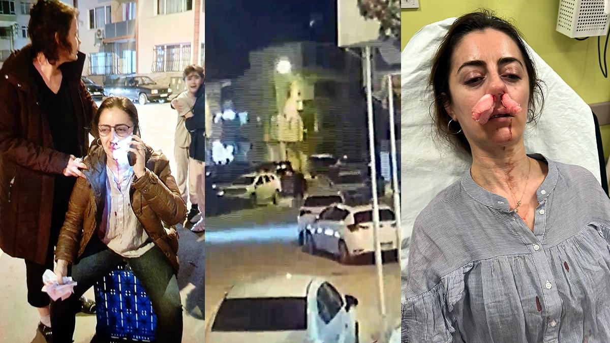 Neyle darp ettiğine inanamayacaksınız! Kadının kocasını kendi eşi sandı: Araba kapısıyla dövdü! - Güncel Haberler