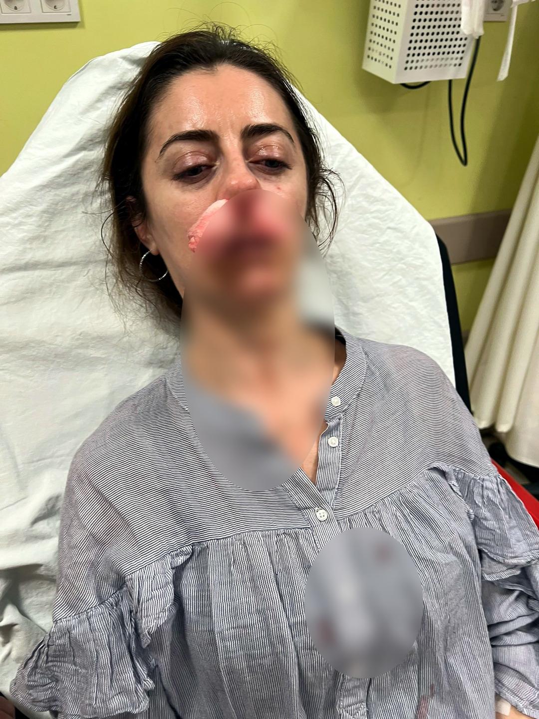 Neyle darp ettiğine inanamayacaksınız! Kadının kocasını kendi eşi sandı: Araba kapısıyla dövdü! 3