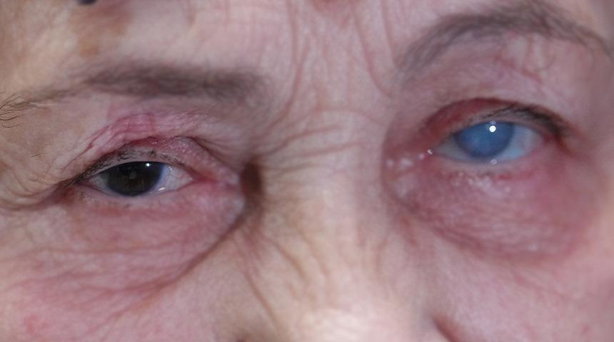 Sisler içinden aydınlığa kavuştu! Resmen ikinci kez hayata gözlerini açtı...