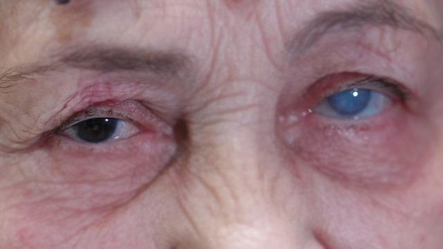 Sisler içinden aydınlığa kavuştu! Resmen ikinci kez hayata gözlerini açtı...