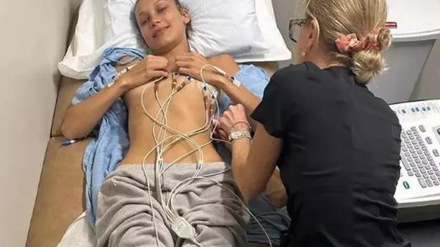 Bella Hadid'in hastalığı ne? Ünlü model tedavi anlarını paylaştı