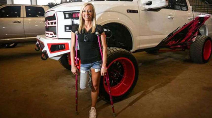 Mini etek giyebilmek i&ccedil;in bacağını kestirdi!