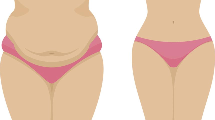 Kalın bel ve göbek hangi tehlikeli hastalığın habercisi?