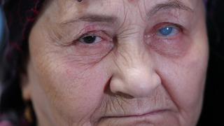 Yıllar sonra aydınlığa kavuşan kadın! İki gözünden de umudu kesmişti: Yeniden hayat verdiler