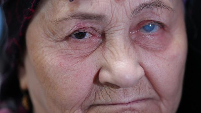 Yıllar sonra aydınlığa kavuşan kadın! İki gözünden de umudu kesmişti: Yeniden hayat verdiler